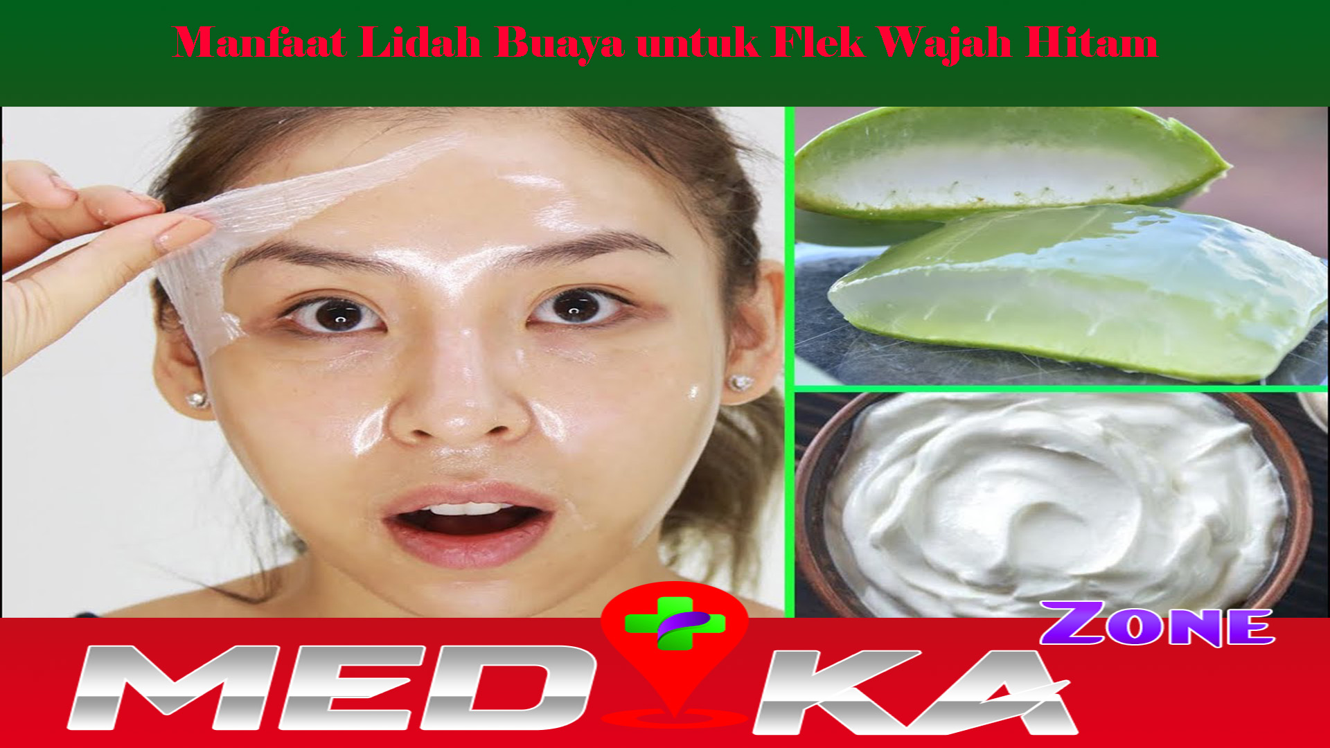 Manfaat Lidah Buaya untuk Flek Wajah Hitam